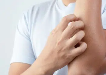 Why Does Pre Workout Make You Itch