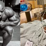 Flex Wheeler Kidney Covid