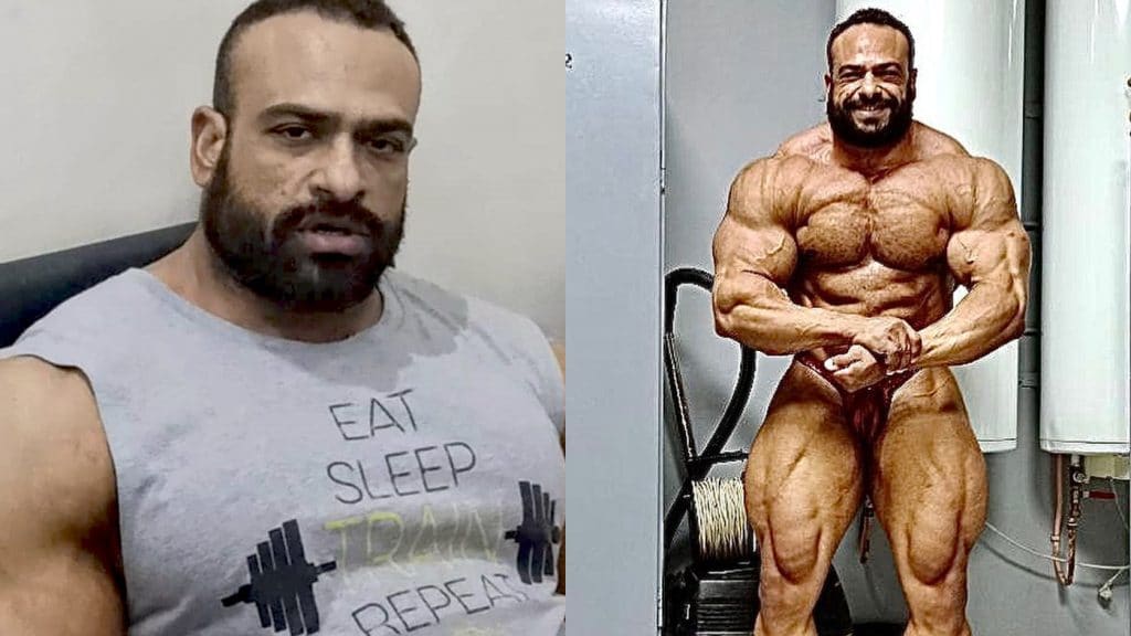 Mohamed El Emam Injured In Car Accident