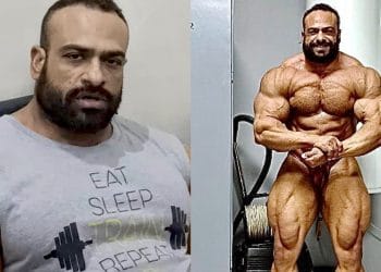 Mohamed El Emam Injured In Car Accident