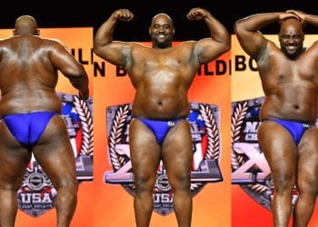 Fredrick Hurt Controversy