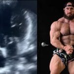 Antoine Vaillant Heart Condition