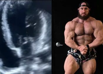 Antoine Vaillant Heart Condition