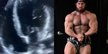 Antoine Vaillant Heart Condition