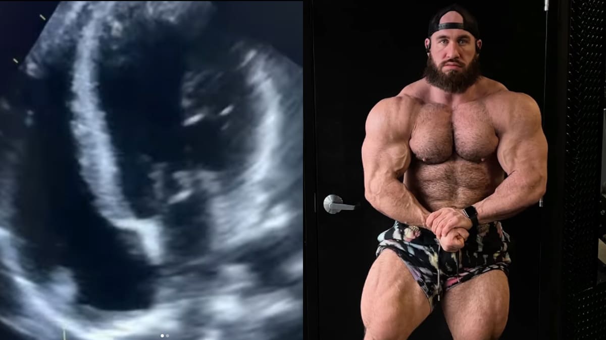 Antoine Vaillant Heart Condition