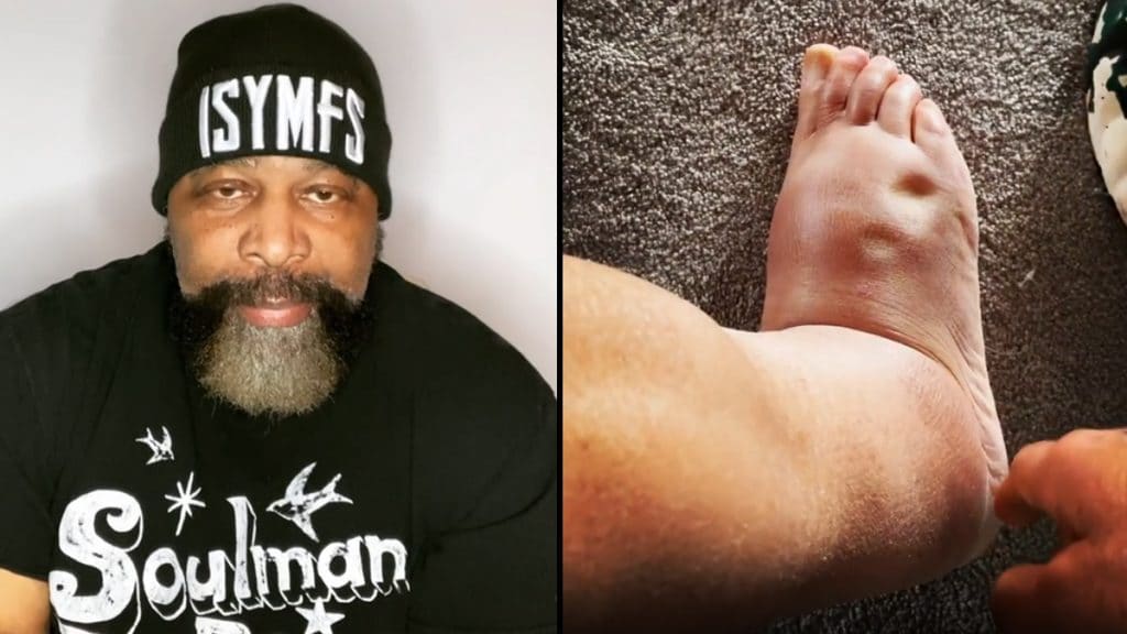 Ct Fletcher Anti Rejection Medication