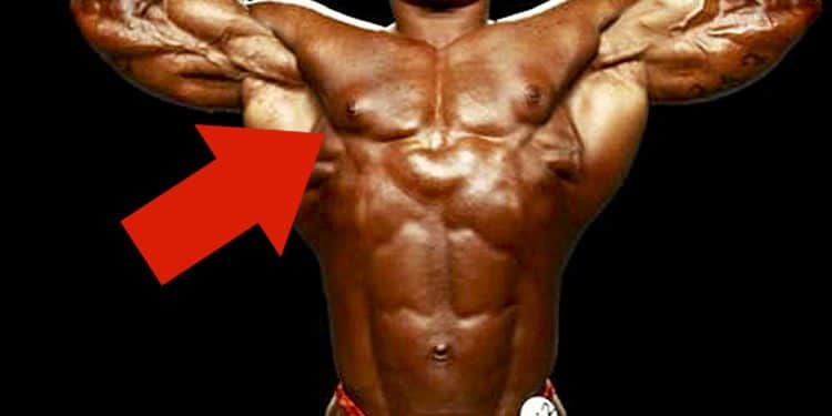 Gyno In Bodybuilding