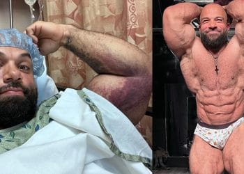 Jon De La Rosa Injury