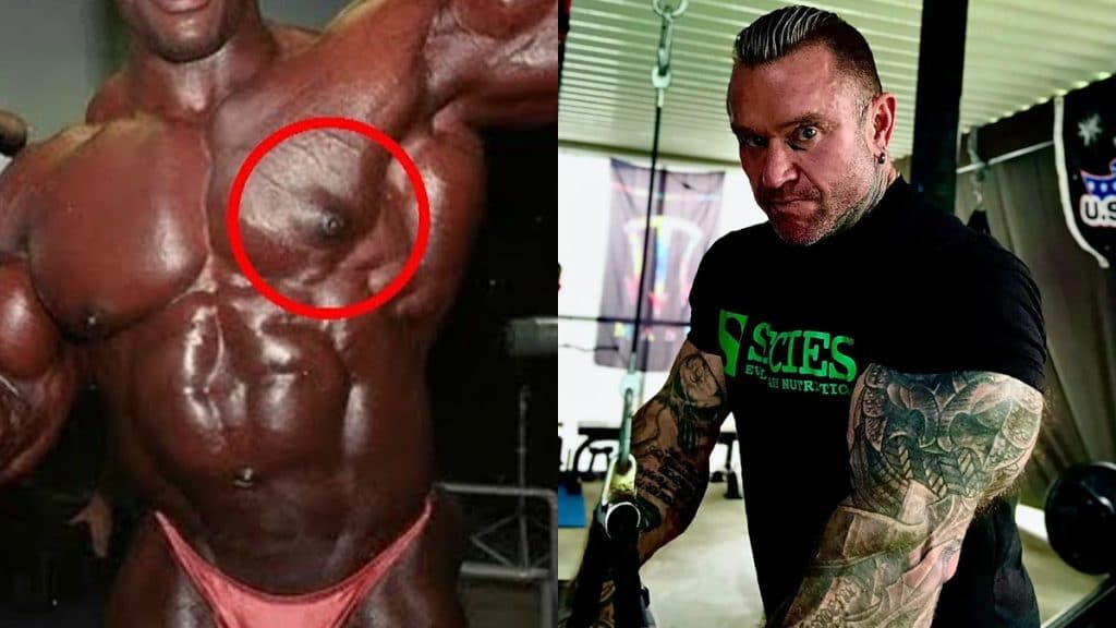 Lee Priest Gyno Bodybuilding