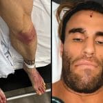 Calum Von Moger Nice To Be Alive