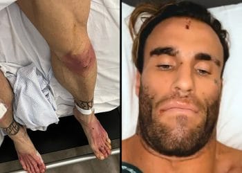 Calum Von Moger Nice To Be Alive