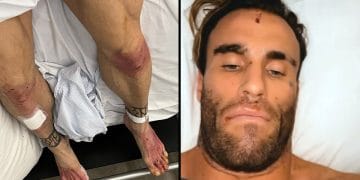 Calum Von Moger Nice To Be Alive