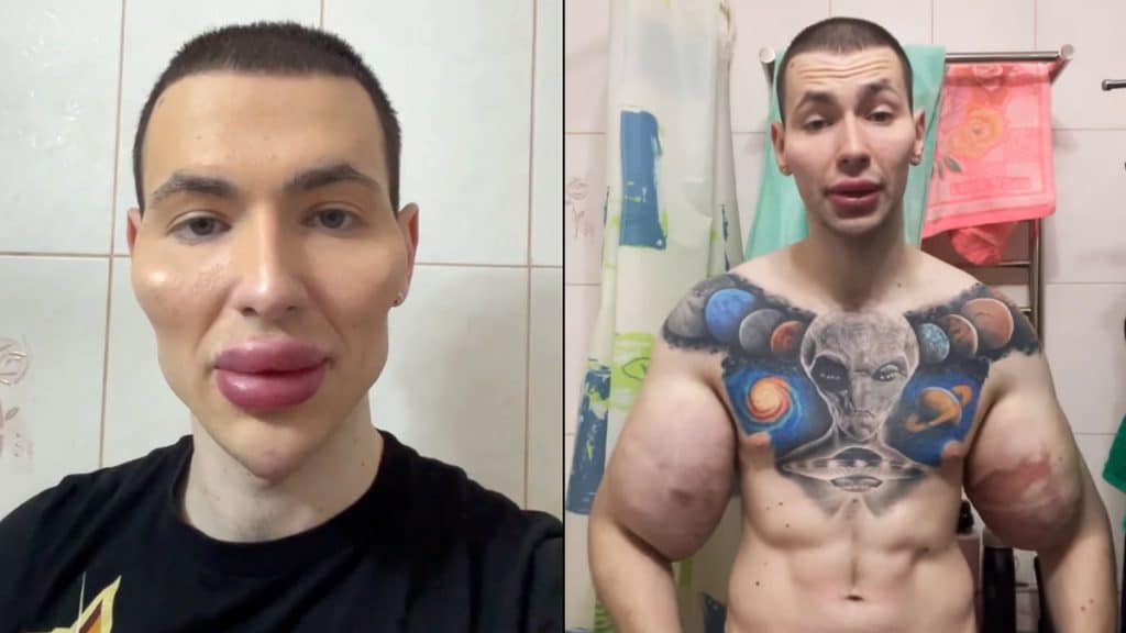Synthol Kid Alien Injection Face
