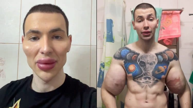 Synthol Kid Alien Injection Face