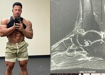 Patrick Moore Injury Update