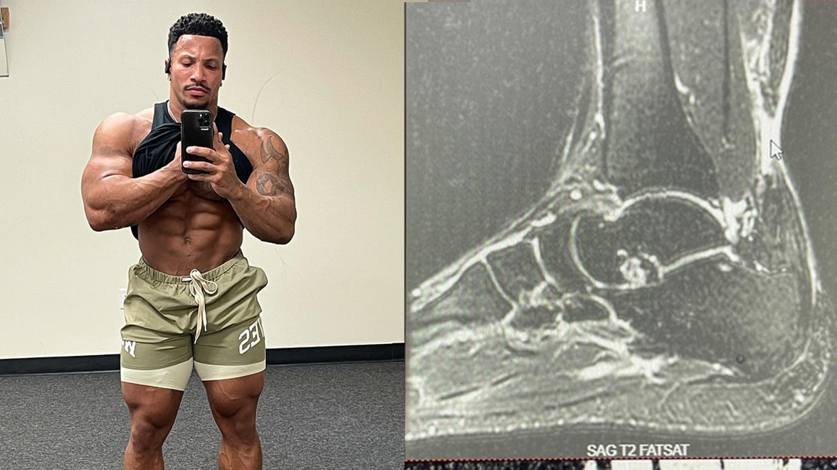 Bodybuilder Patrick Moore Gives Update On Achilles Tendon Injury That ...