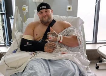 Evan Singleton Bicep Surgery