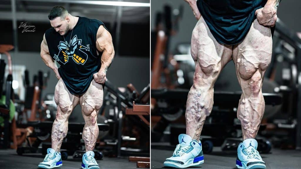 Nick Walker Shows Huge Varicose Veins