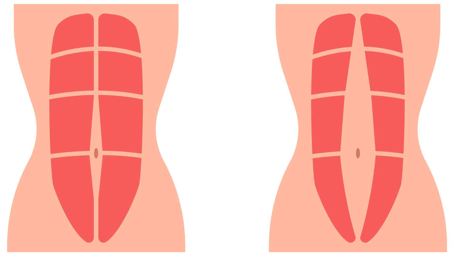15 Best Diastasis Recti Exercises for Moms to Get Their Body Back