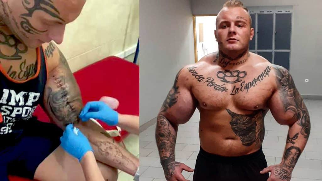 Szymon Komandos Synthol Surgery