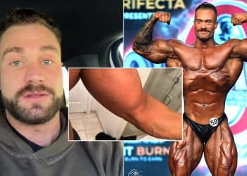 Chris Bumstead Torn Bicep