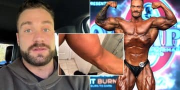 Chris Bumstead Torn Bicep
