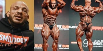 Big Ramy on stem cell therapy