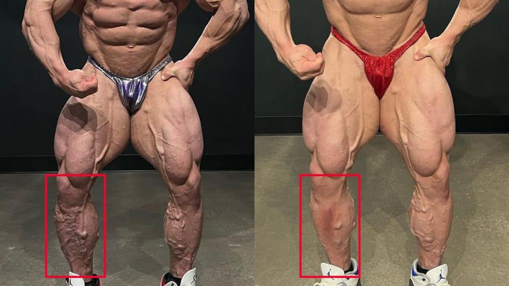 Nick Walker Fixed Veins