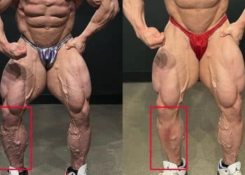 Nick Walker Fixed Veins