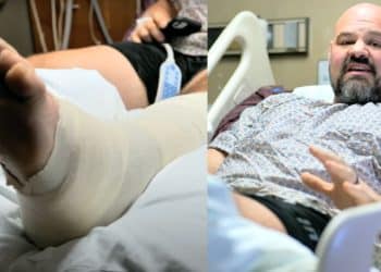 Brian Shaq Leg Recovery