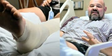 Brian Shaq Leg Recovery