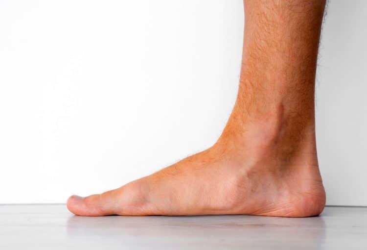 Male Ankle