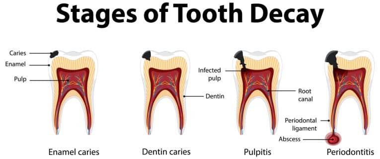 Can You Brush Your Teeth While Fasting (Debunking Myths) – Fitness Volt