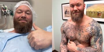 Hafthor Bjornsson Pec Tear Surgery