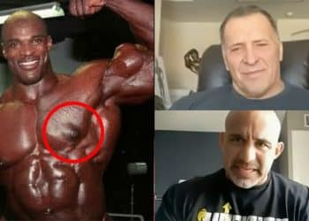Milos Sarcev, Jose Raymond, Gyno, Gyno surgery gone wrong