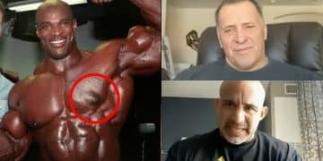 Milos Sarcev, Jose Raymond, Gyno, Gyno surgery gone wrong