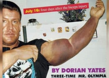 Dorian Yates Bicep Tear 1994 Olympia