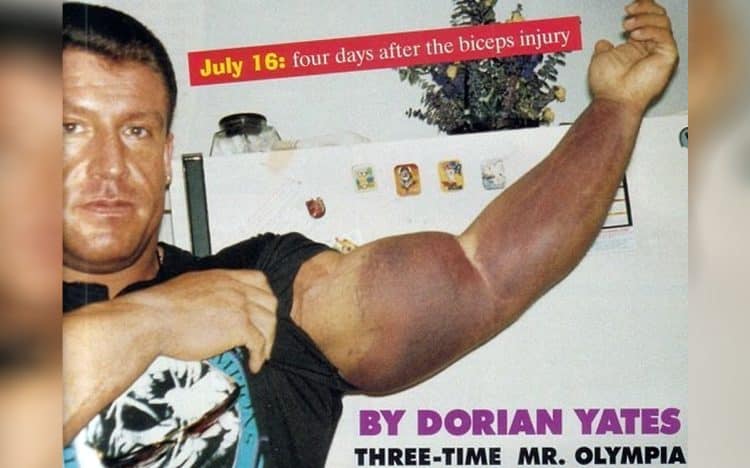 Dorian Yates Bicep Tear 1994 Olympia