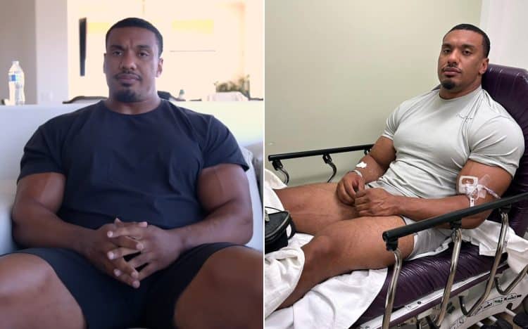 Larry Wheels Recovery Update