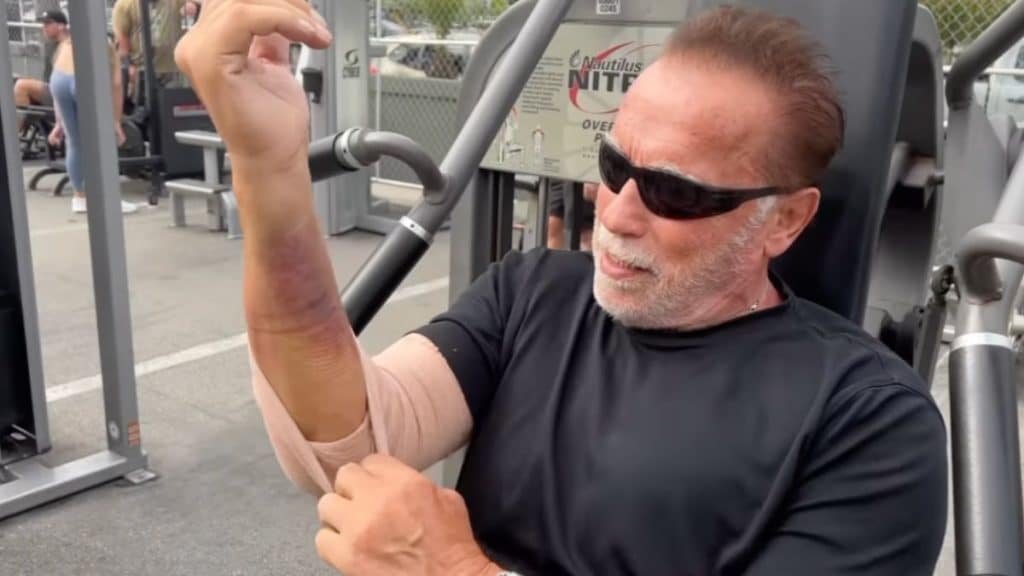 Arnold Schwarzenegger Pump Post Surgery