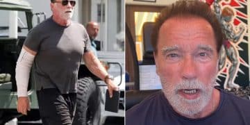 Arnold Schwarzenegger Nerve Damage Surgery