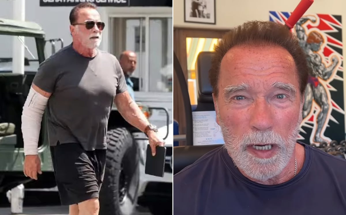 Arnold Schwarzenegger Shows Off Bandaged Arm After Undergoing Elbow ...