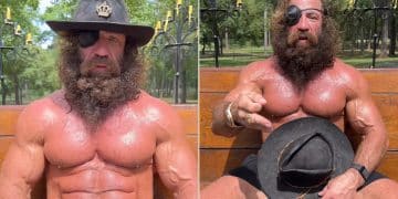 Liver King Eye Injury