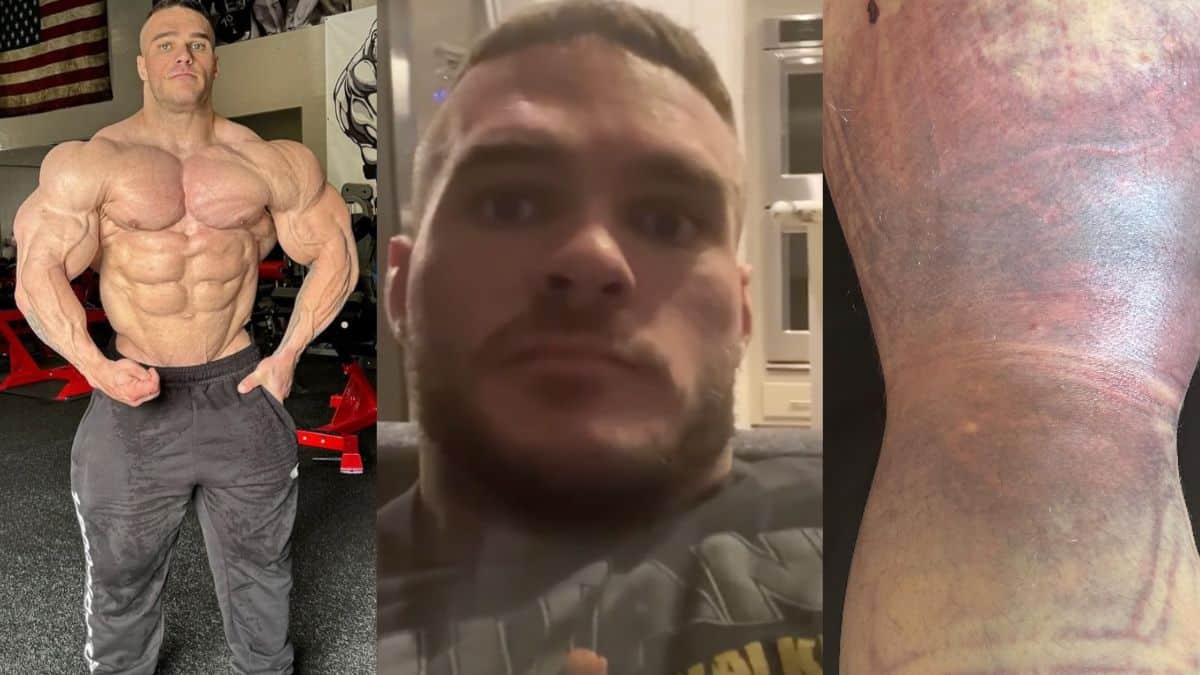 Nick Walker On 2023 Olympia