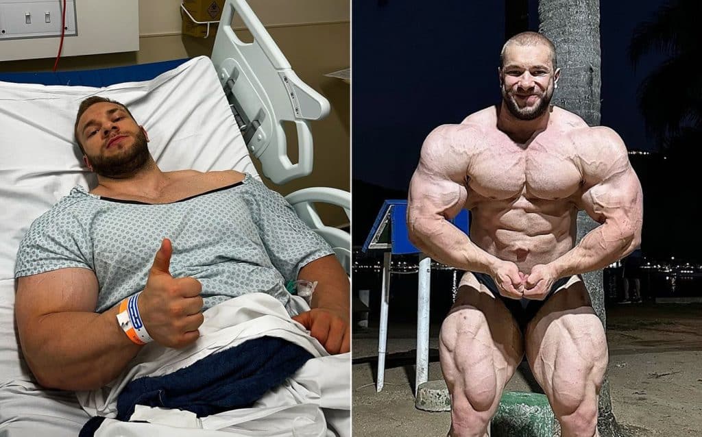 Good Vito Hernia Surgery