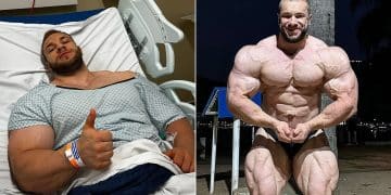 Good Vito Hernia Surgery