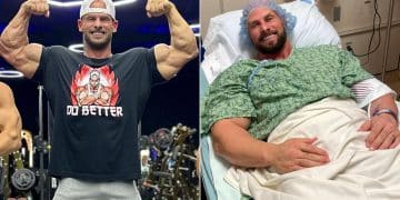 Joey Swoll Gives Heart Surgery Update