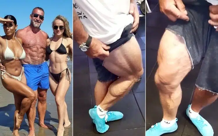 Dorian Yates Massive Quads