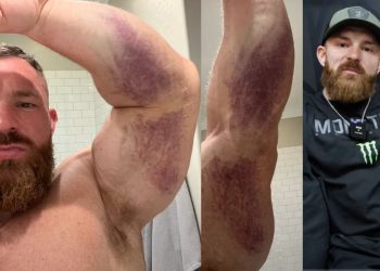 Flex Lewis Talks Injury