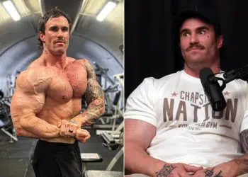 Calum Von Moger Health Scares Coma
